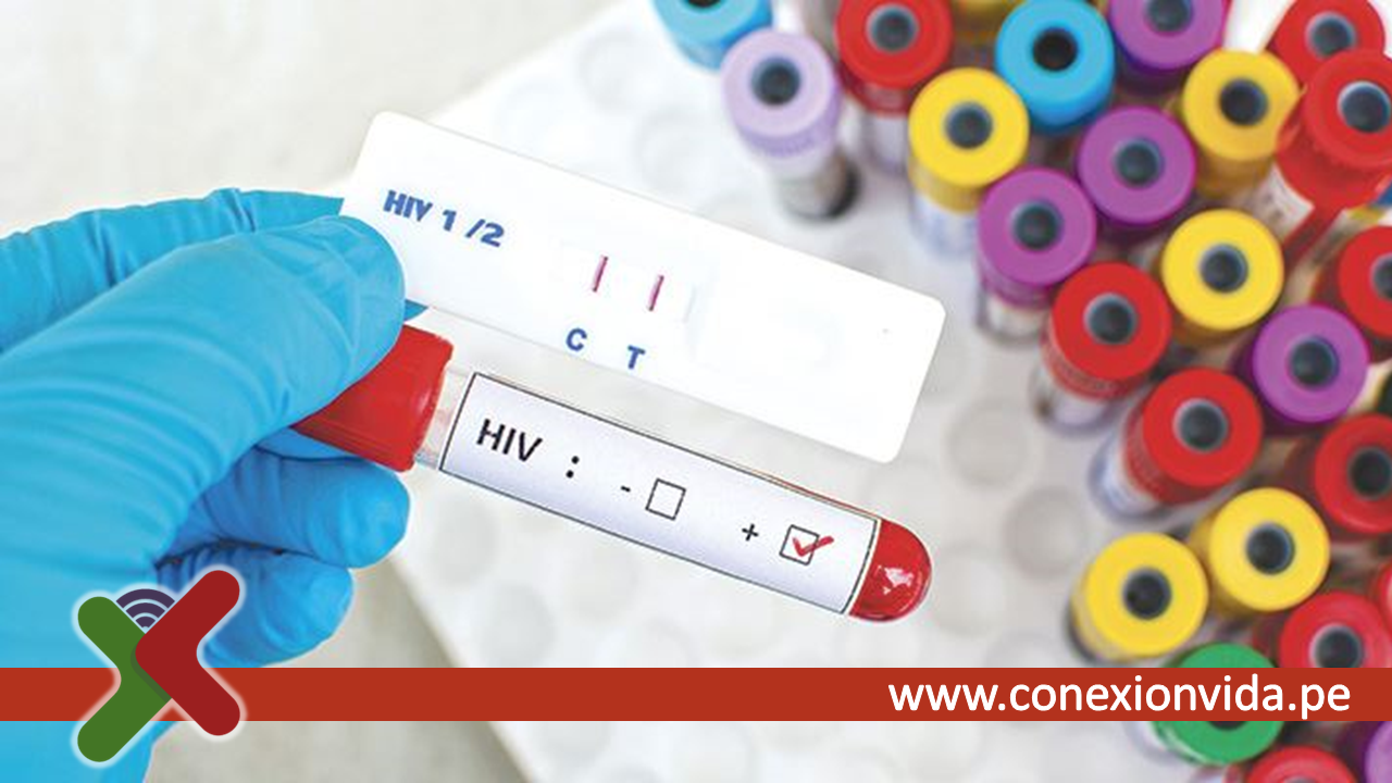 Las falsas noticias sobre las formas de transmisión del VIH que circulan en las redes