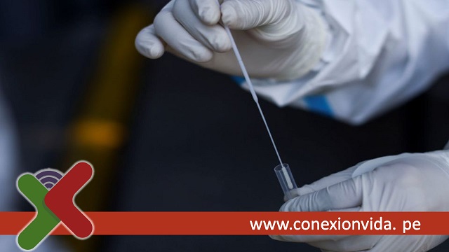 test rectal para detectar el coronavirus - Conexión Vida